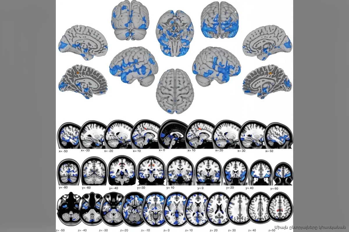 Космос меняет структуру мозга: почему астронавты возвращаются на Землю другими людьми